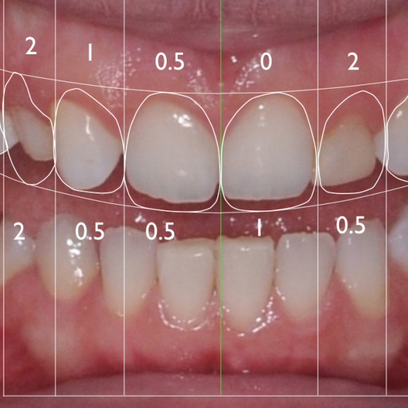 Digital Smile Design- Il tuo nuovo sorriso